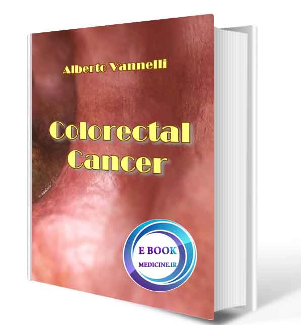 دانلود کتاب  ColorectalCancer 2021 (ORIGINAL PDF)